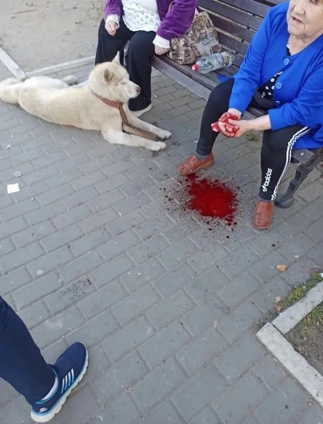 В Коми хозяйский пес насквозь прокусил кисть пенсионерке