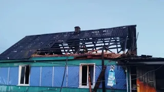 В Коми на женщине вспыхнула одежда из-за неаккуратности с горючим