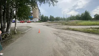 В Коми ребёнок опрокинулся на электросамокате и получил открытую травму живота