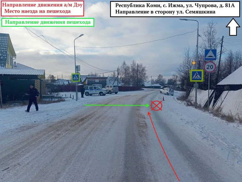Житель Коми сбил женщину на “зебре” и стал фигурантом уголовного дела