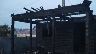 В Коми неосторожность с огнём на даче привела к пожару и травме мужчины