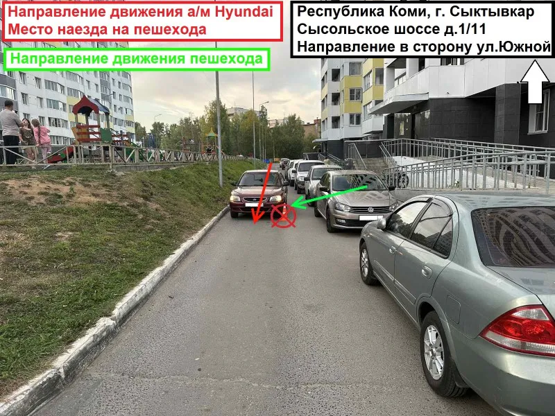 В Коми 5-летний ребенок выбежал прямо под колеса Hyundai Accent